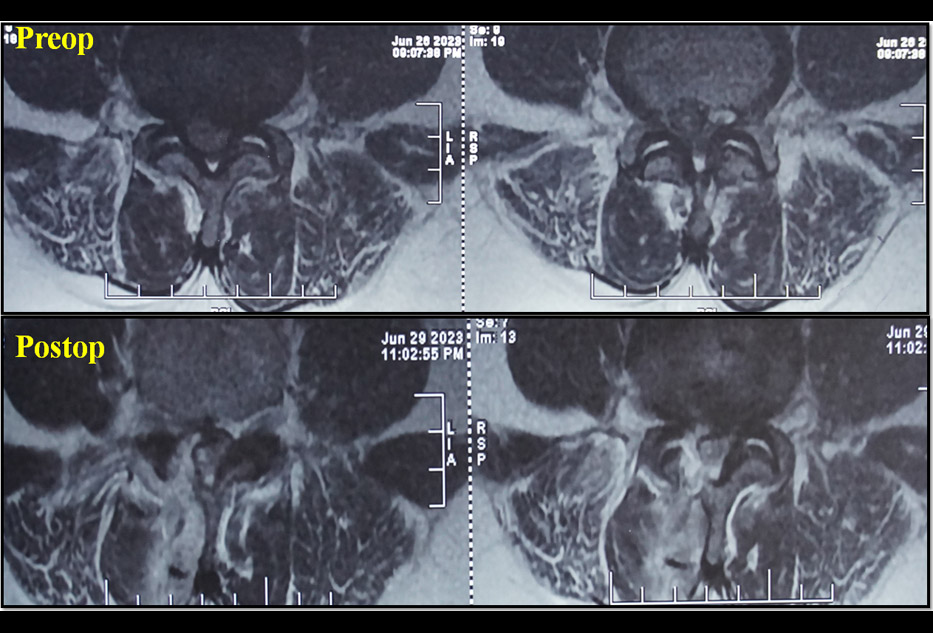 Neurosurgeon in Lucknow, Neurosurgeon in Lucknow - Uttar Pradesh, Neurosurgeon in Lucknow Articles, Neurosurgeon in Lucknow Downloads, Neurosurgeon in Lucknow Blogs, Best Neurosurgeon in Lucknow Contact, Neurosurgery in Lucknow Medicines, Neurosurgery in Lucknow Uttar Pradesh, Neurosurgery Patient in India Lucknow Uttar Pradesh, Neurosurgeon in India Best Case, Best Neurosurgeon in India Books, Best Neurosurgeon in India Hobbies, Neurosurgeon in India Library, www.dranoopsingh.com, India