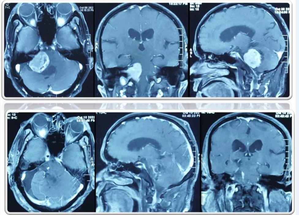 Neurologist Uttar Pradesh, Neurologist Azamgarh, Neurosurgeon in Lucknow, Neurosurgeon in Lucknow - Uttar Pradesh, Neurosurgeon in Lucknow Articles, Neurosurgeon in Lucknow Downloads, Neurosurgeon in Lucknow Blogs, Best Neurosurgeon in Lucknow Contact, Neurosurgery in Lucknow Medicines, Neurosurgery in Lucknow Uttar Pradesh, Neurosurgery Patient in Lucknow Uttar Pradesh, Neurosurgeon in Lucknow Best Case, Best Neurosurgeon in Lucknow Books, Best Neurosurgeon in Lucknow Hobbies, Neurosurgeon in Lucknow Library, www.dranoopsingh.com, India